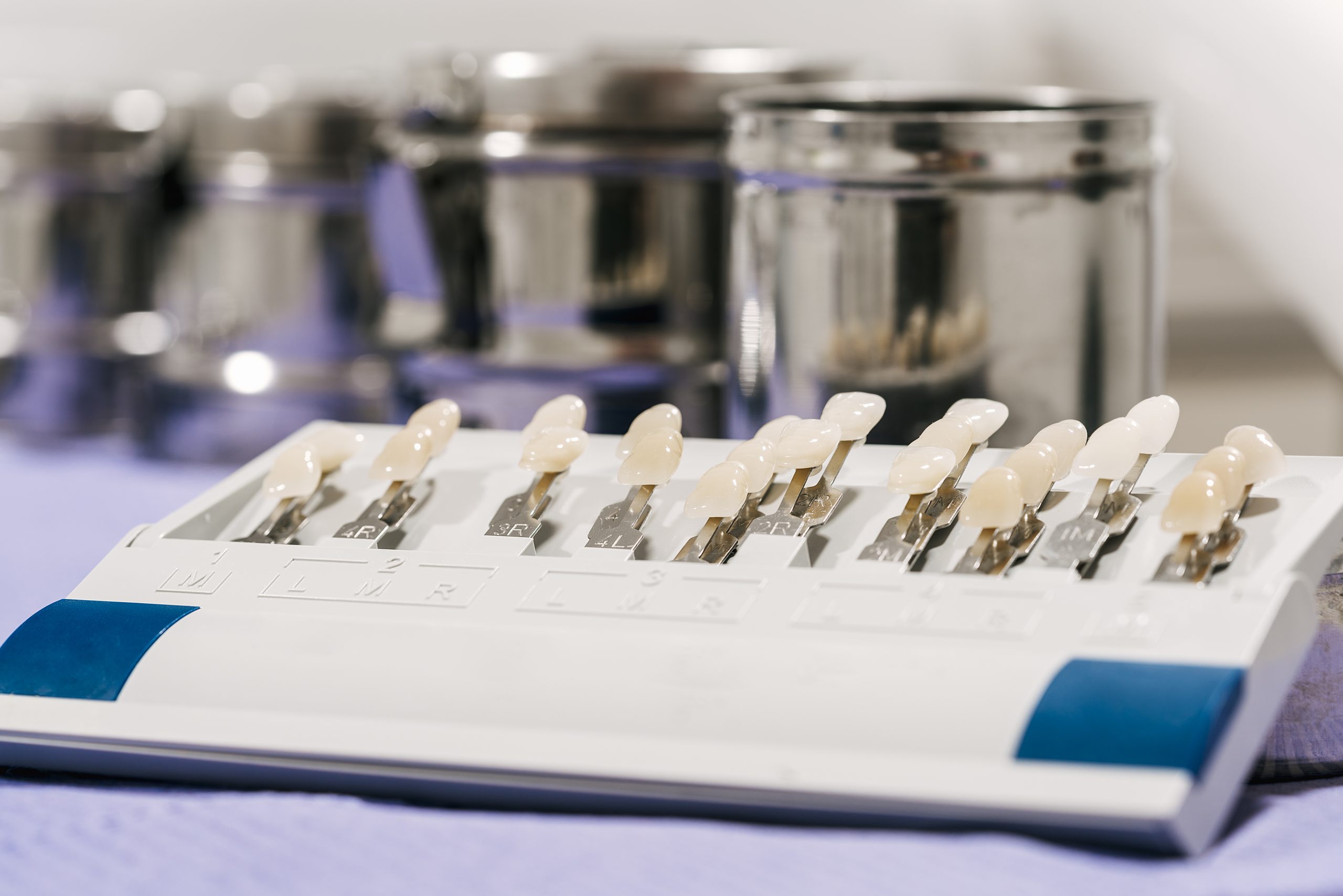 Set of dental veneers displayed on a table at Reston Serenity Smiles in Reston, VA